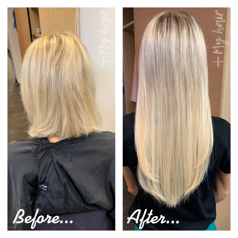 Before and after extensions